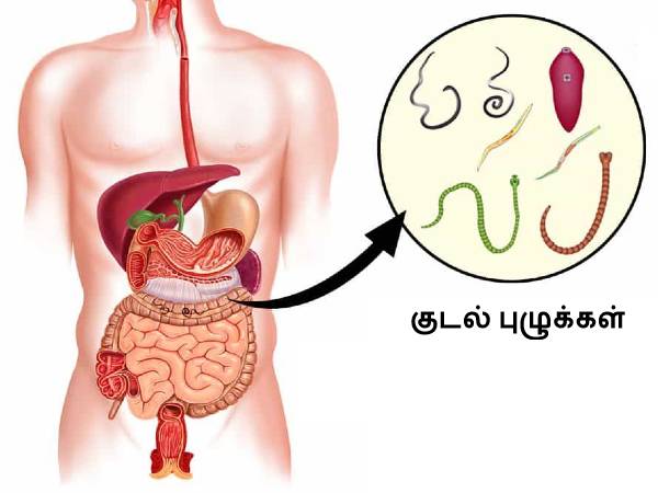 மூன்றே நாட்களில் வயிற்றுப் புழுக்களை அழிக்கும் சில கை வைத்தியங்கள்!