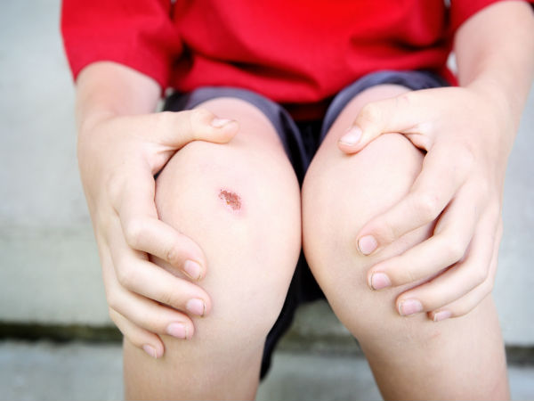 உங்க உடலிலுள்ள காயங்களை ஆற்றவும் சீக்கிரம் குணப்படுத்தவும் இந்த உணவுகளை சாப்பிட்டா போதுமாம்!