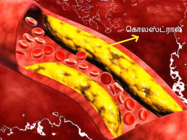 எச்சரிக்கை! இந்த விஷயங்கள் உடலில் கெட்ட கொலஸ்ட்ரால் அளவை அதிகரிக்குமாம்... உஷாரா இருங்க..