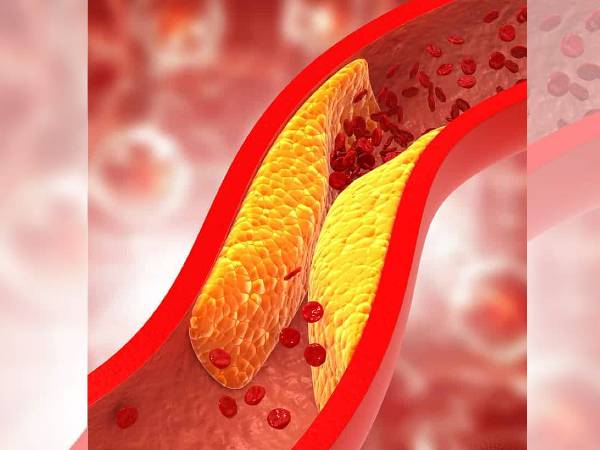 ஹை-கொலஸ்ட்ரால் பிரச்சனை இருக்கா? அப்ப இந்த பழங்களை தினமும் சாப்பிடுங்க சரியாயிடும்...