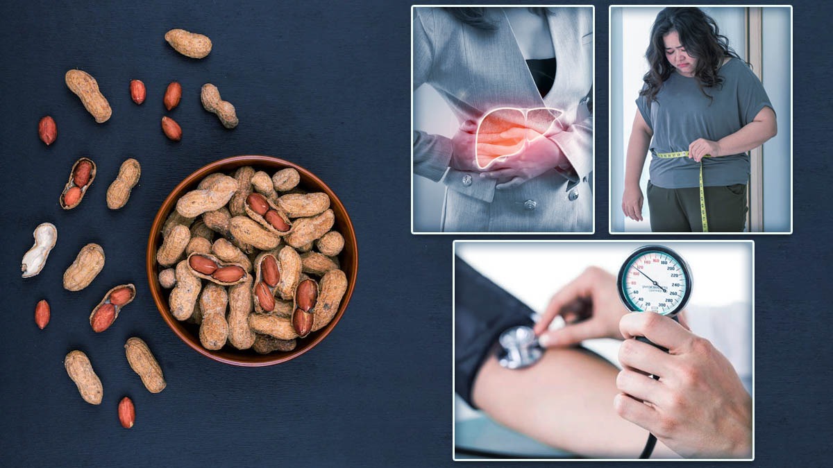 இந்த பிரச்சனை இருந்தா வேர்க்கடலை சாப்பிடாதீங்க.. இல்லன்னா உங்க நிலைமை