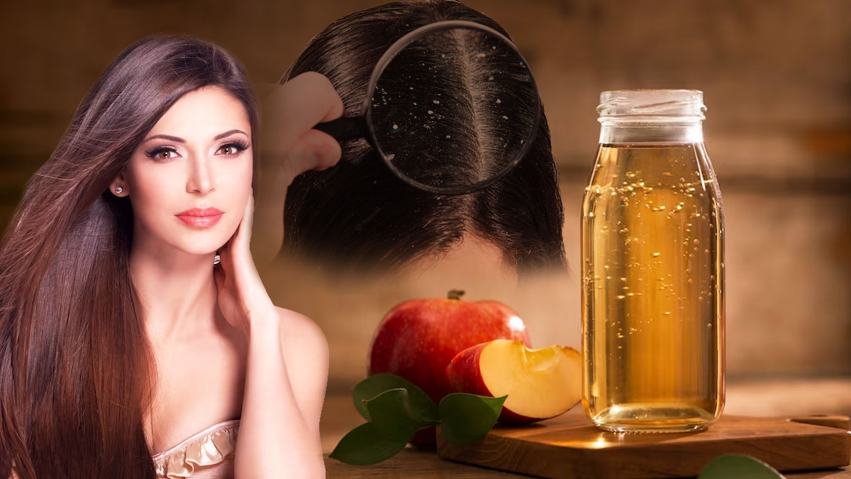 உங்க தலையில பொடுகு அதிகமா இருக்கா? அப்ப ஆப்பிள் சீடர் வினிகரை இந்த