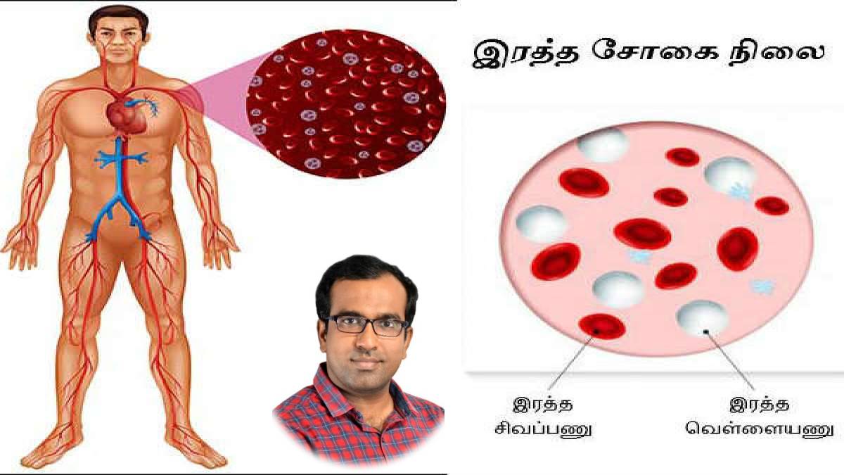 Dr Farooq Abdullah Says About Anemia Symptoms And What To Eat To Prevent