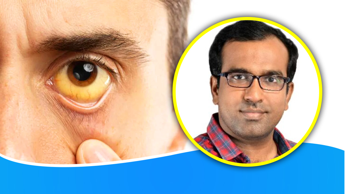 மஞ்சள் காமாலை எவ்வளவு ஆபத்தானது என்பது குறித்து கூறும் டாக்டர் ஃபரூக்