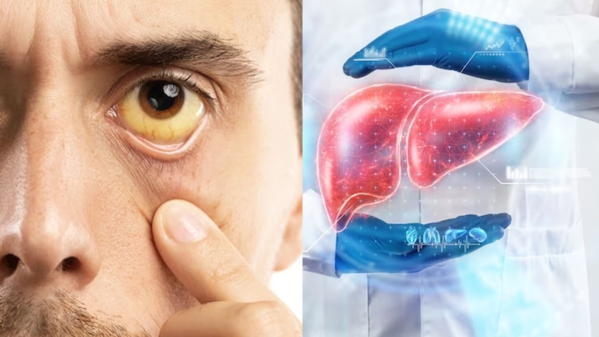 உங்க முகத்தில் இந்த மாற்றங்கள் இருந்தால் உங்க கல்லீரல் பெரிய ஆபத்தில்