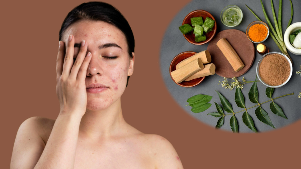Summer Skin Care Tips In Tamil Top 5 Homemade Face Packs For Acne Prone Skin