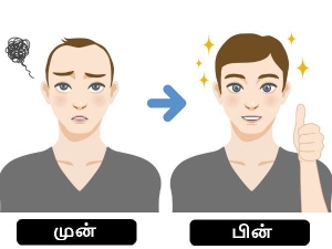 Page 20 Hair Care Tips In Tamil Women Hair Care Tips In Tamil Men Hair Care Tips In Tamil À® À®¨ À®¤à®² À®ªà®° À®®à®° À®ª À®ª